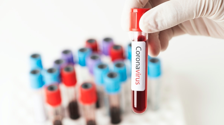 Two Hungarian Recovered Covid-19 Patients Test Positive Again