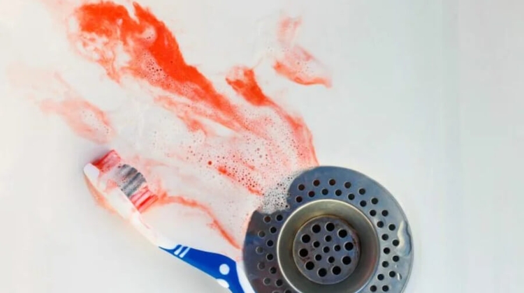 Bleeding Gums – A Common Disease? by EverGreen Dental Budapest