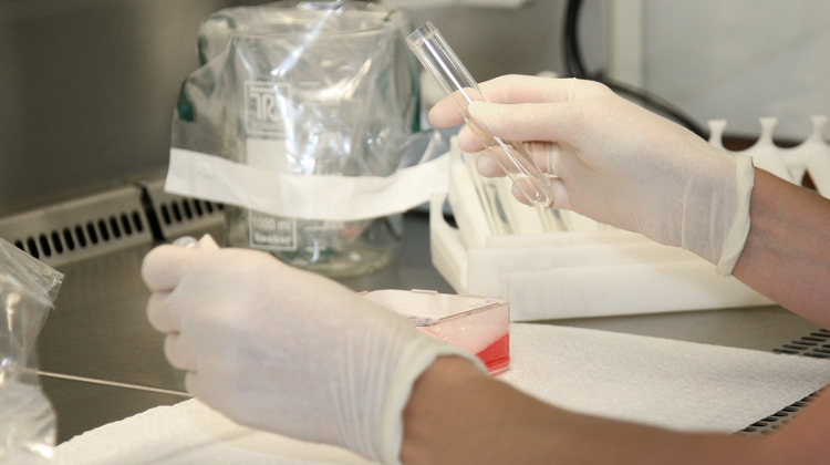 Hungary Research Team Isolates Coronavirus