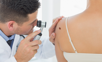 Exposure to Sunlight by FirstMed