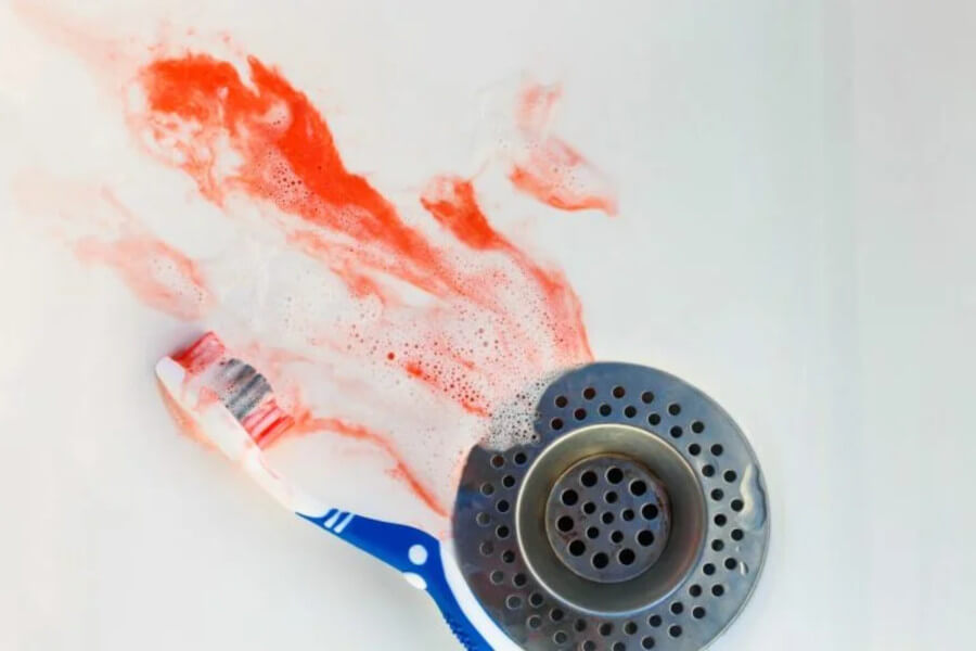 Bleeding Gums – A Common Disease? by EverGreen Dental Budapest