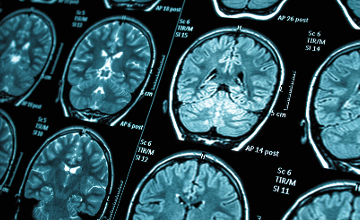 The World of Neurosurgery by Wáberer Medical Center Budapest