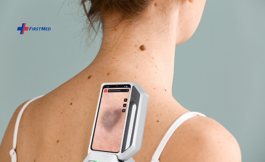 FirstMed Budapest Introduces Groundbreaking AI-Powered Digital Mole Screening for Early Skin Cancer Detection