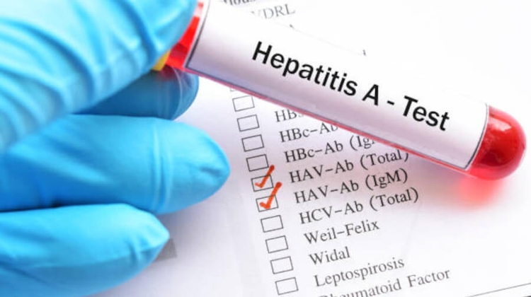Health Authority Warns of Rise in Hepatitis A Cases in Hungary