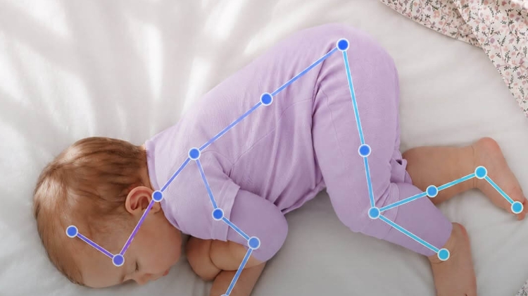 New Sensor-Free Premature Baby Monitoring Enabled by AI in Hungary