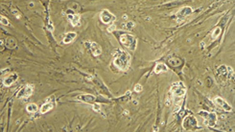 Nine Indicted For Fraud In Stem Cell Treatment Case In Hungary