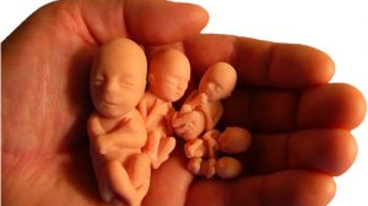 Hungarians Still Liberal On Abortion
