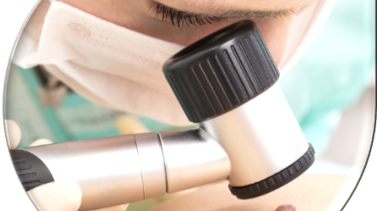 'Mole Removal', By FirstMed Budapest