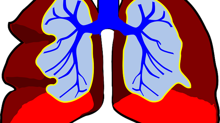 Hungary Can Start Lung Transplants