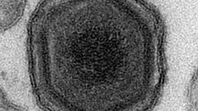 Hungary Authority Warns Of African Swine Fever Near Border