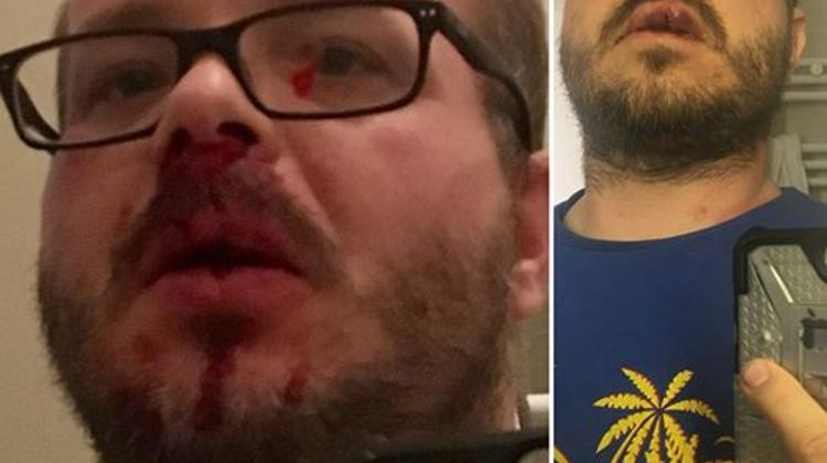 Journalist Beaten, For Trying To Officially Complain, By KFC Security Guard In Downtown Budapest